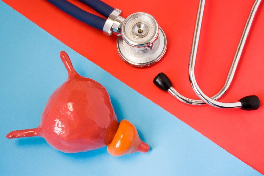 Diagnóstico cáncer de próstata CDMX
