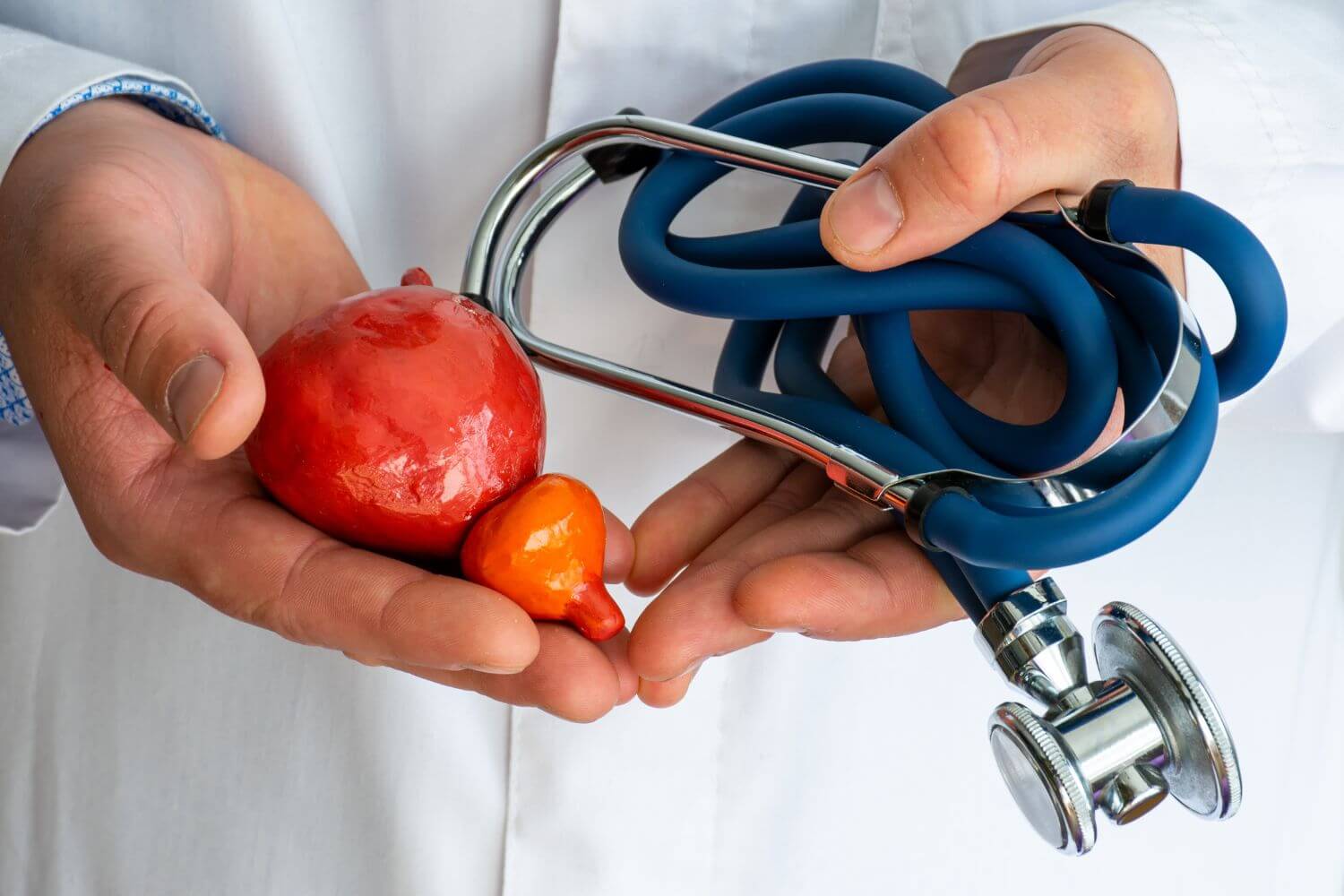 ¿Qué es el cáncer de próstata