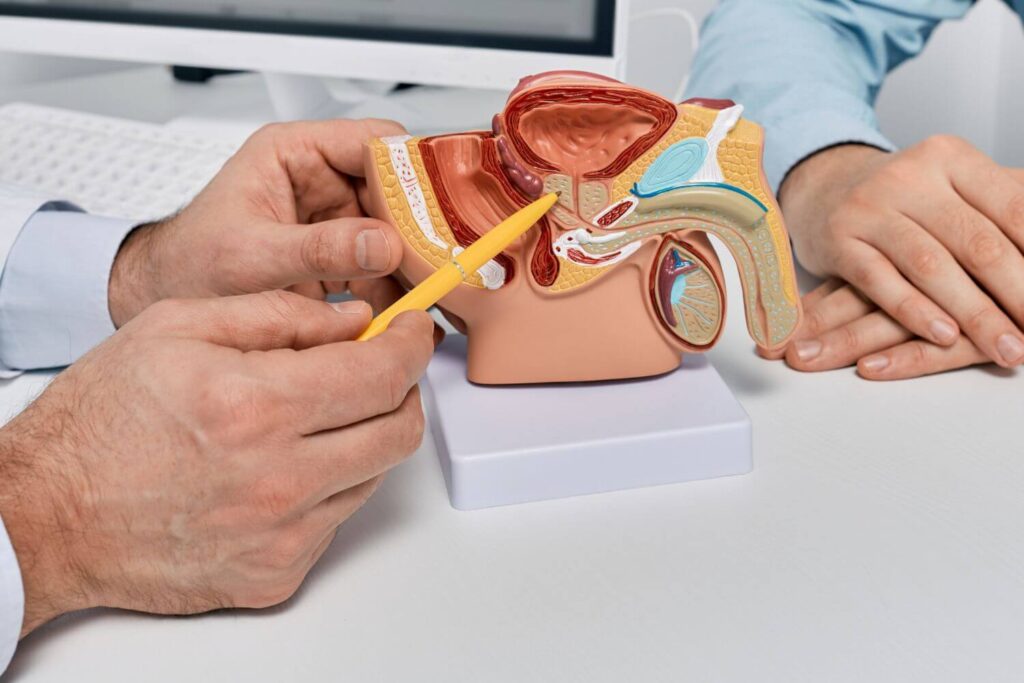Especialista en prostatectomía CDMX